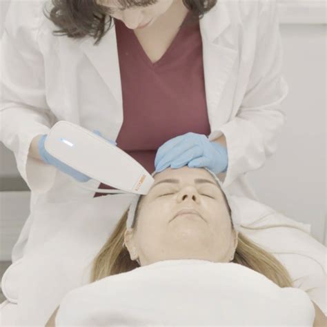 Fractional Laser Resurfacing (Venus Viva®) » Canada MedLaser.